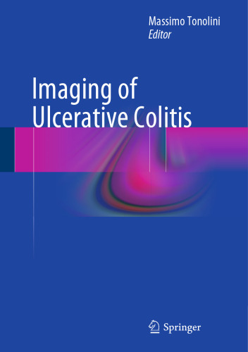 Imaging of Ulcerative Colitis