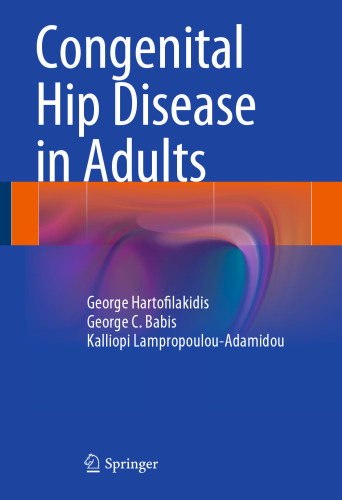 Congenital Hip Disease in Adults