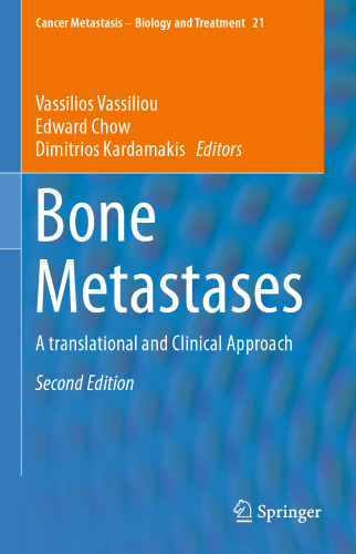 Bone Metastases: A translational and Clinical Approach