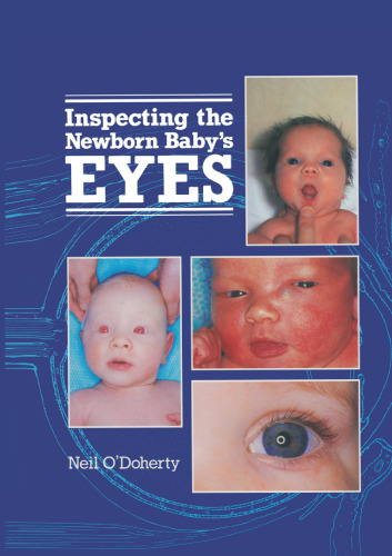Inspecting the Newborn Baby’s Eyes