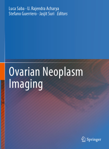 Ovarian Neoplasm Imaging