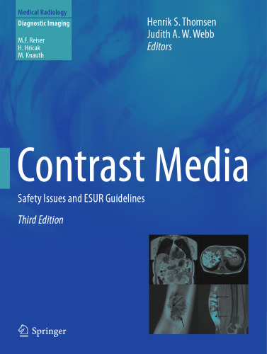 Contrast Media: Safety Issues and ESUR Guidelines