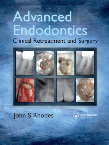 Advanced Endodontics