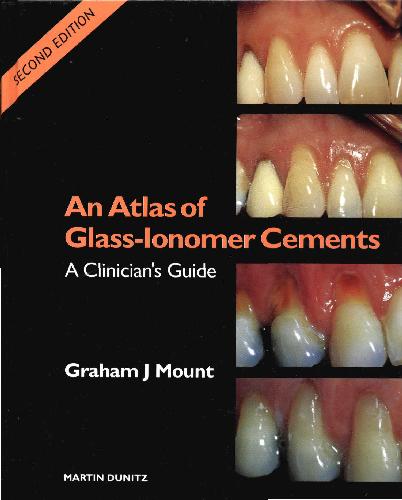 An Atlas of Glass Ionomer Cements