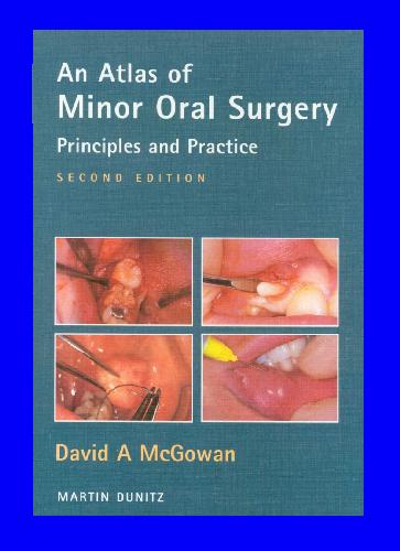 Atlas of Minor Oral Surgery: Principles and Practice