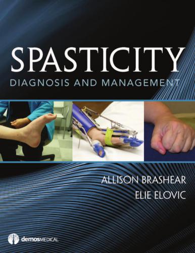 Spasticity: Diagnosis and Management