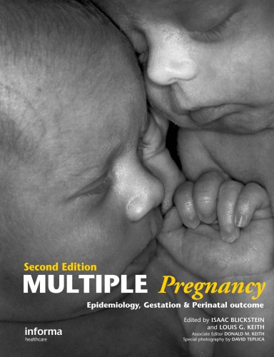 Multiple Pregnancy: Epidemiology, Gestation, and Perinatal Outcome