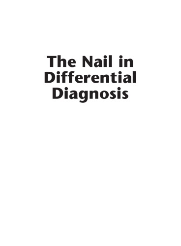 Nail in Differential Diagnosis