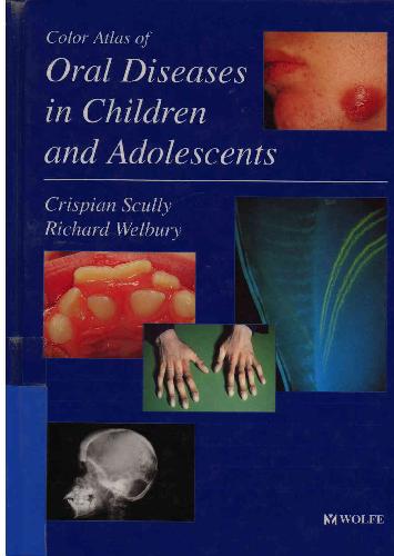 Colour Atlas of Oral Diseases in Children and Adolescence