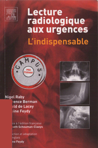 Lecture radiologique aux urgences : L'indispensable