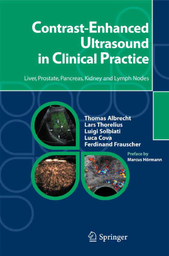Contrast-enhanced ultrasound in clinical practice: liver, prostate, pancreas, kidney and lymph nodes