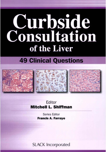 Curbside Consultation of the Liver: 49 Clinical Questions