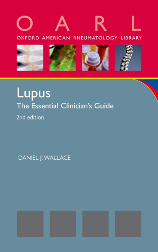 Lupus: The Essential Clinician's Guide