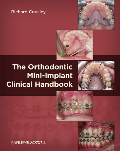 The Orthodontic Mini-implant Clinical Handbook