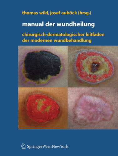 Manual der Wundheilung: Chirurgisch-dermatologischer Leitfaden der modernen Wundbehandlung