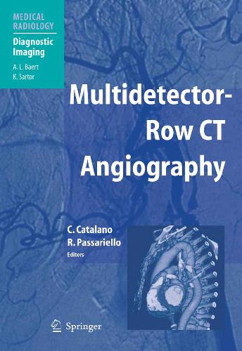 Multidetector - Row CT Angiography Medical Radiology Diagnostic Imaging