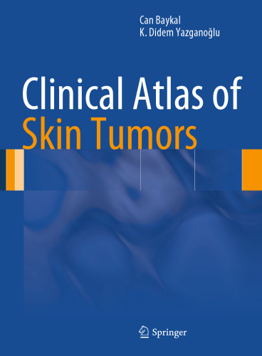 Clinical Atlas of Skin Tumors