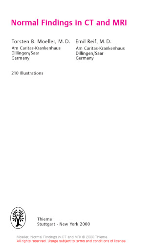 Normal Findings on CT and MRI