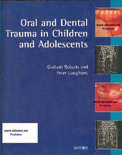 Oral and Dental Trauma