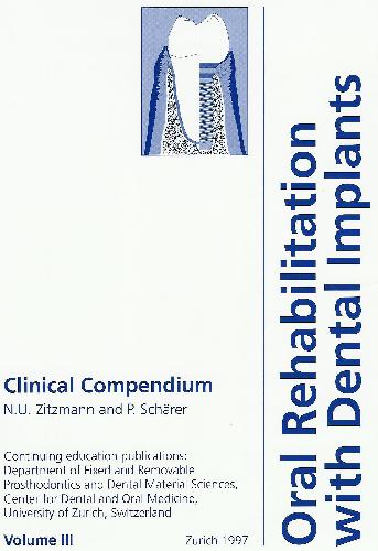 oral rehabilitation with dental implants