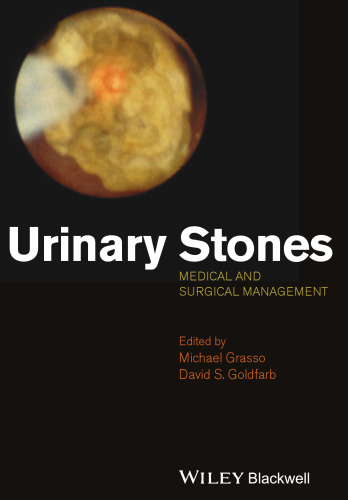 Urinary Stones: Medical and Surgical Management