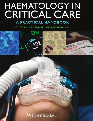 Haematology in Critical Care