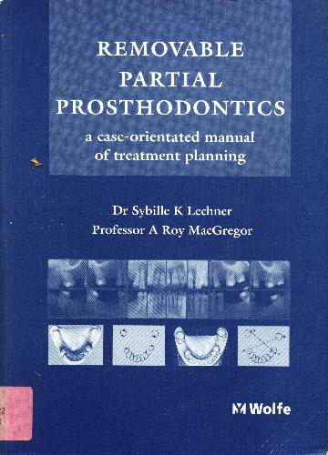 Removable Partial Prosthodontics
