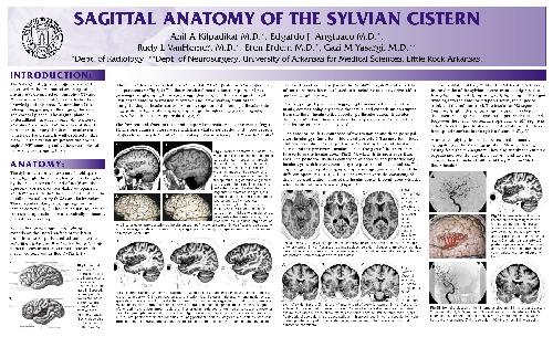 SAGITTAL ANATOMY OF THE SYLVIAN CISTERN