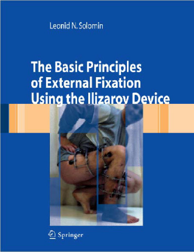 The Basic Principles of External Skeletal Fixation Using the Ilizarov Device