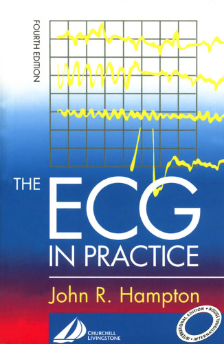 The Ecg In Practice