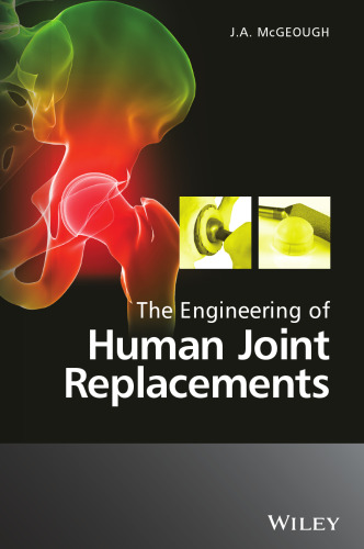 The Engineering of Human Joint Replacements