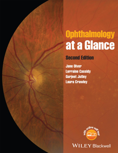 Ophthalmology at a Glance