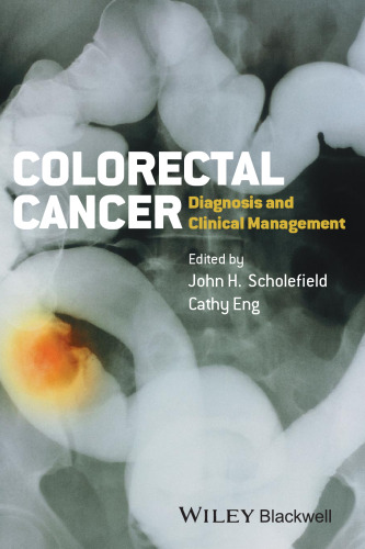Colorectal Cancer: Diagnosis and Clinical Management