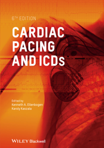 Cardiac Pacing and ICDs