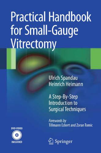 Practical Handbook for Small-Gauge Vitrectomy: A Step-By-Step Introduction to Surgical Techniques