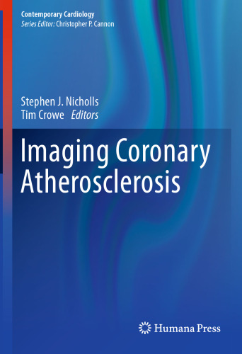 Imaging Coronary Atherosclerosis