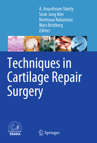 Techniques in Cartilage Repair Surgery