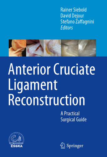 Anterior Cruciate Ligament Reconstruction: A Practical Surgical Guide