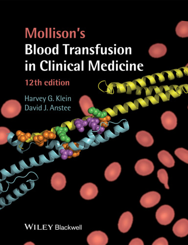 Mollison's blood transfusion in clinical medicine