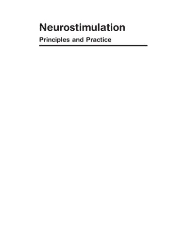 Neurostimulation : principles and practice