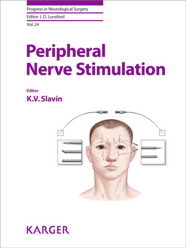Peripheral nerve stimulation : 10 tables