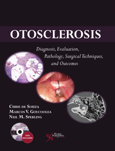 Otosclerosis: Diagnosis, Evaluation, Pathology, Surgical Techniques, and Outcomes