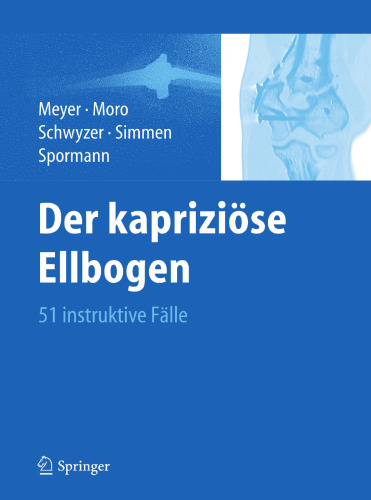 Der kapriziöse Ellbogen: 51 instruktive Fälle