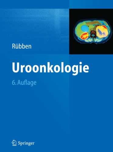 Uroonkologie