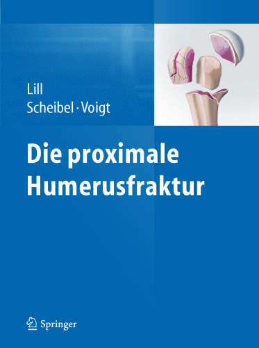 Die proximale Humerusfraktur