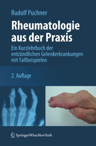 Rheumatologie aus der Praxis: Ein Kurzlehrbuch der entzündlichen Gelenkerkrankungen mit Fallbeispielen