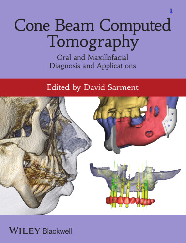 Cone Beam Computed Tomography: Oral and Maxillofacial Diagnosis and Applications