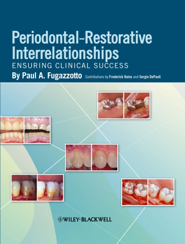 Periodontal-Restorative Interrelationships