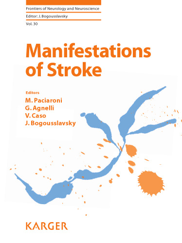 Manifestations of Stroke
