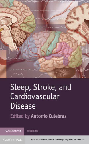 Sleep, Stroke and Cardiovascular Disease